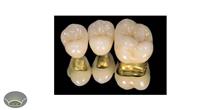 استفاده از رگه های شمش طلا در علم دندان پزشکی 